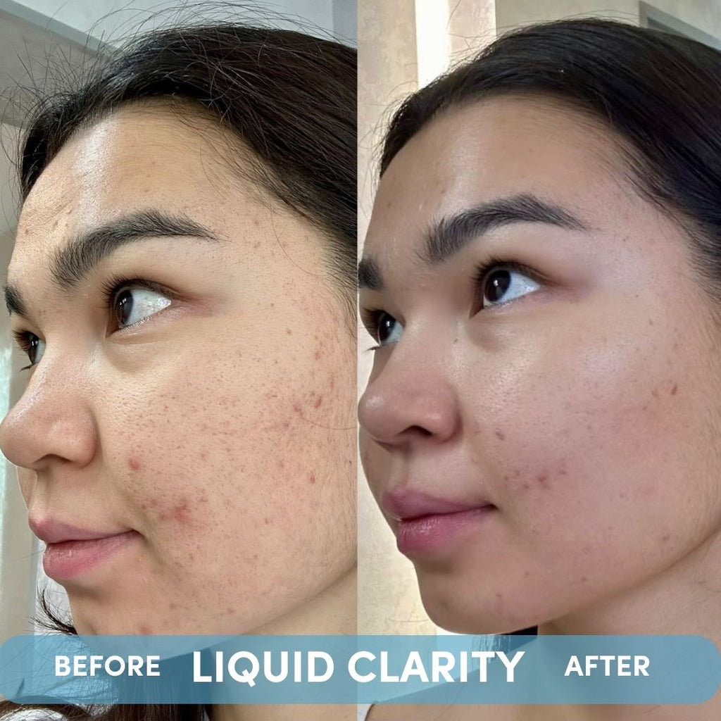 LIQUID CLARITY