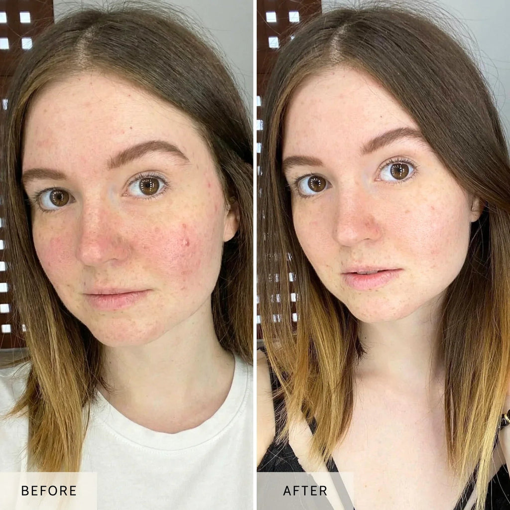 LED Red Light Therapy Face Mask