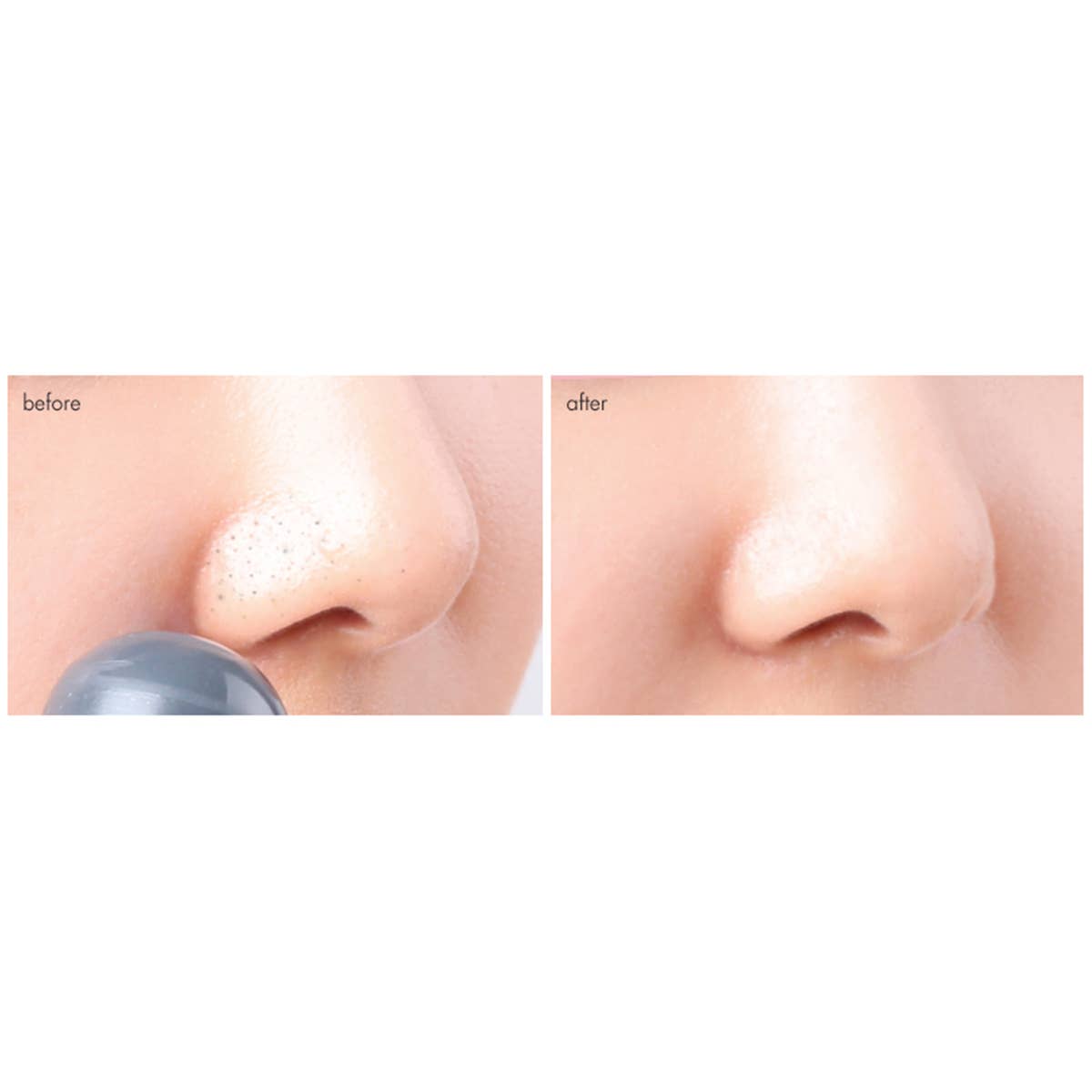Tako Pore Blackhead Scrub Stick