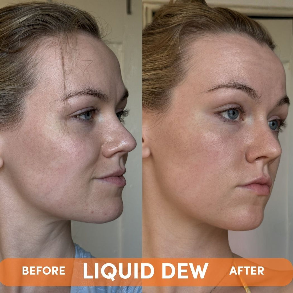 LIQUID DEW